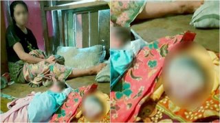 สุดฮือฮา..แม่คลอดลูกแฝด คนแรกสภาพปกติ อีกคนมีแต่หัว ไร้ลำตัว