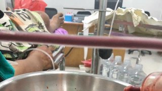 คอเหล้า! ดูไว้ภาพเลือดสดๆที่ได้จากการล้างทัองของชายวัยกลางคนที่ดื่มเหล้าขาวเป็นประจำ