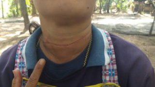 เชือกว่าว เฉือนคอหญิง 41 หวิดคอขาด