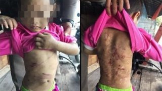 ตำรวจเข้าช่วยเด็กชายวัย 6 ขวบ โดนพ่อเลี้ยง-แม่แท้ๆ ทารุณเฆี่ยนตีทั้งตัวมีแต่รอยแผล