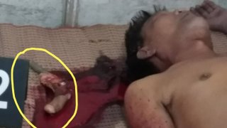 หนุ่มใหญ่ป่วยโรคจิตเวชคิดสั้นยิงตัวเองดับ