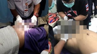 สยอง!หนุ่มเกิดอารมณ์เปลี่ยวสอดองคชาติเข้าไปในท่อ เอาออกไม่ได้ 5 วัน จนเน่าอาจต้องตัดทิ้ง