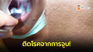 หนุ่มวัย 15 มีไข้ ปวดหัว อ่อนเพลีย จึงไปหาหมอ พบว่ากลายเป็นโรคที่ติดจากการจูบ