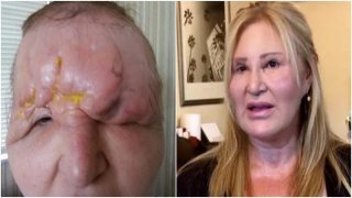 อดีตนางแบบชื่อดัง ฝากอุทาหรณ์ต้องเสียโฉมเพราะพิษศัลยกรรม ชีวิตเหมือนตายทั้งเป็น