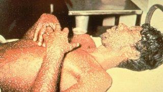 ย้อนรอยโรคระบาดในไทย ก่อนเจอวิกฤตเชื้อไวรัสโควิด-19