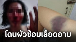 สาวถูกผัวทำร้ายร่างกาย !! ซ้อมเลือดอาบ เคยให้โอกาสมาหลายครั้ง เห็นแก่ครอบครัว ครั้งนี้โดนอีก