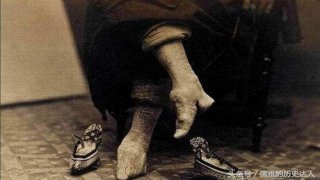 รัดเท้า : ประเพณีที่โหดร้ายต่อผู้หญิงจีนในประวัติศาสตร์