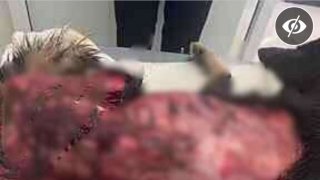 น้องหมาถูกแล่เนื้อเถือหนังน่าสงสารวิ่งมาให้คนช่วย