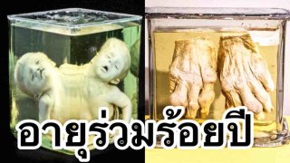 สุดน่ากลัว! 16 ของดอง จาก พิพิธภัณฑ์ มัทเทอร์