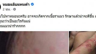 สาวเอาแมวมาเลี้ยง เลี้ยงไปเลี้ยงมา มีแผลเต็มตัว