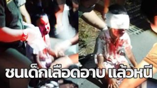 สลด! จยย.ชนแล้วหนี เด็กเจ็บเลือดอาบ