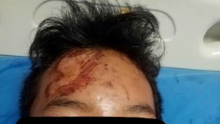 น้องถูกวัยรุ่นเจ้าถิ่นหาเรื่อง ถีบรถจักรยานยนต์จนล้ม เจ็บทั้งตัว