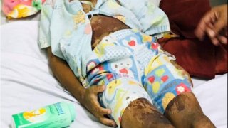 รุ่นพี่หวังดี อ้างเห็นน้องเป็นหิด เลยเอาซีม่าชุบสำลีทาให้