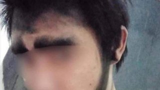 ลูกเมายาคลั่ง ฆ้อนตีหัวพ่อวัยชราอายุ 80 ปี เจ็บหนัก