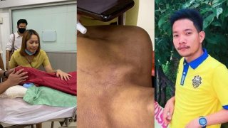 ดับคาเรือนจำ!! จนท.อ้างช็อคหมดสติ แต่รอยช้ำที่ตัวเพียบ