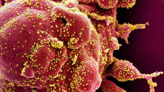 นักวิจัยพบว่า "โควิดเคยแพร่ระบาด เมื่อ 20,000 ปีก่อน"