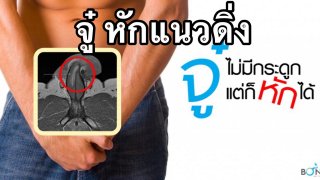 &ldquo;จู๋&rdquo; หักแนวดิ่ง‼️ สยองฉีกยาว 3 เซนติเมตร⁉️