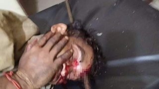 อึ้ง! หนุ่มก่อสร้างตกอาคารสูง20ชั้น ถูกเหล็กเท่าแขนเสียบทะลุศีรษะรอดตายหวุดหวิด