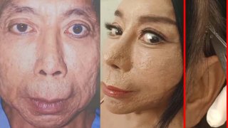 'สิตางศุ์ บัวทอง' ไลฟ์สดถอดแม็กดึงหนังหน้าหลังศัลยกรรมอีกรอบ ลั่นปากกาพร้อมวงเลยค่ะ