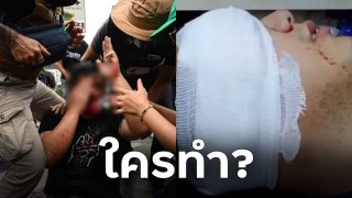 บาดแผลไฮโซนัทเกิดจากอะไรใครทำ?? หลังร่วมชุมนุมด้วยได้รับบาดเจ็บ