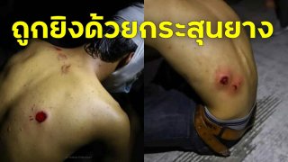 เพจดังเผยภาพ!! ผู้ถูกยิงด้วยกระสุนยาง เล่าว่า "เห็นตำรวจขับรถไล่ยิงมา"