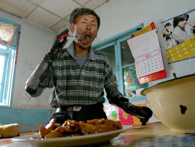 ชายจีนเจ๋งวางแผน 8 ปีสร้างแขนเทียมไบโอนิคได้สำเร็จ