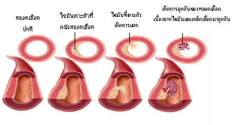 น้ำมันปลามีประโยชน์