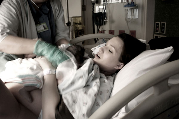 ผ่าตัดคลอด VS คลอดปกติ