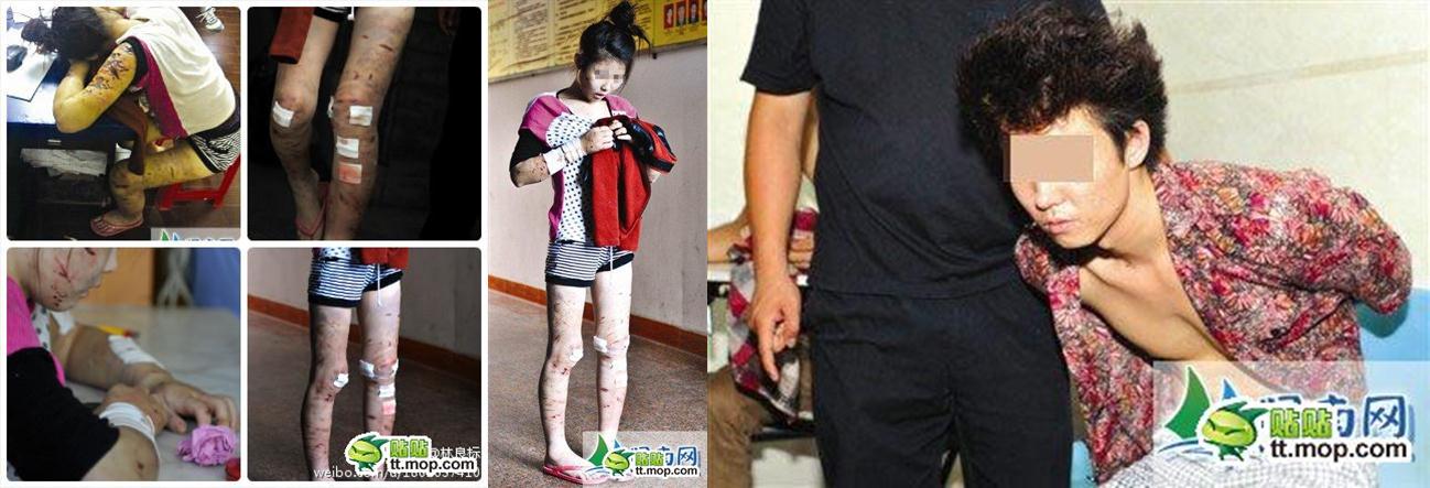 ทำไมในจีน เพศหญิงถึงต้องถูกทำร้ายอย่างทารุน แบบนี้
