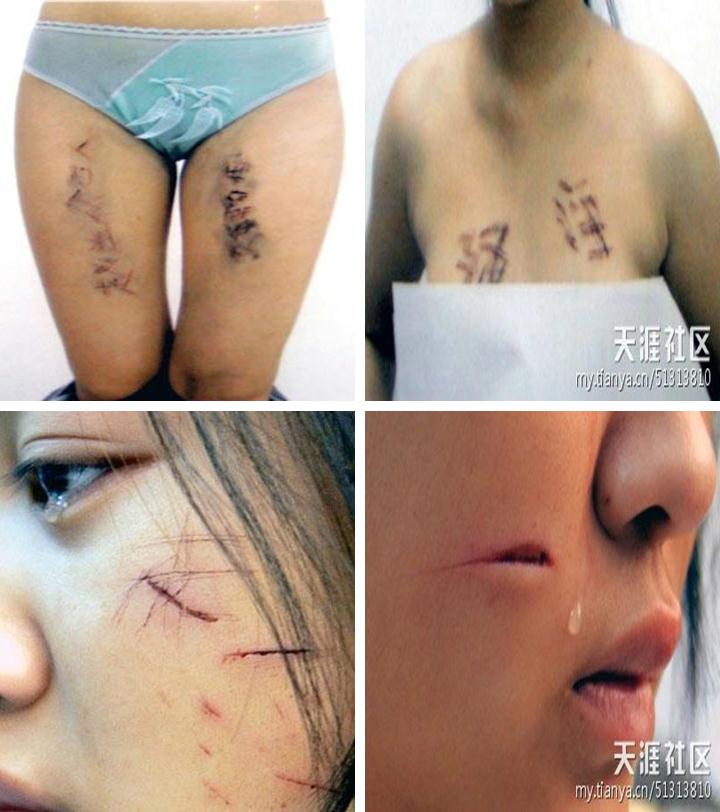 ทำไมในจีน เพศหญิงถึงต้องถูกทำร้ายอย่างทารุน แบบนี้
