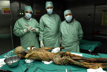 Researchers-examine-Otzi