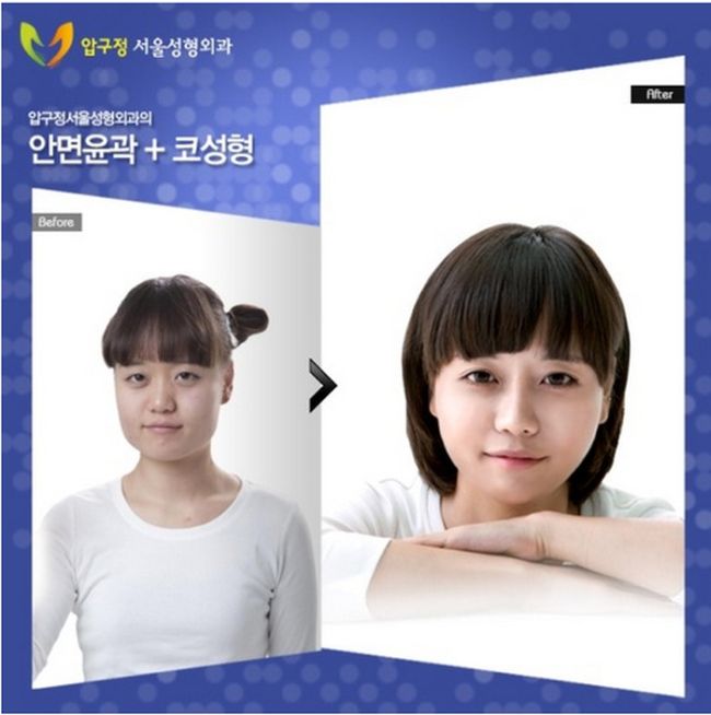 มาดูหนุ่ม สาวเกาหลีก่อน-หลัง ศัลยกรรม