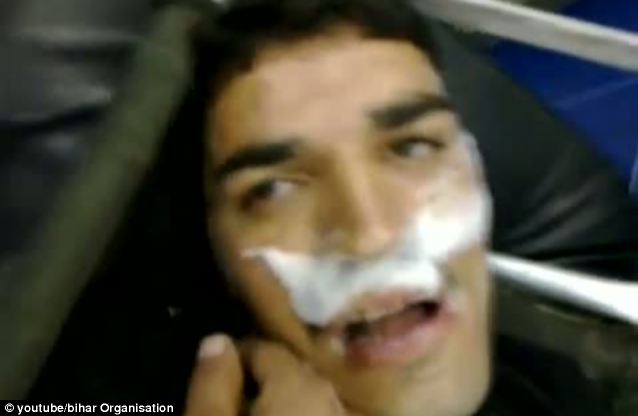 ได้รับบาดเจ็บ: โพสต์วิดีโอใน Facebook และ YouTube จะปรากฏขึ้นเพื่อแสดงให้ผู้ที่ตกเป็นเหยื่อของการโจมตีระบอบการปกครองของซีเรียอาเลปโปน้ำลายฟูมปาก