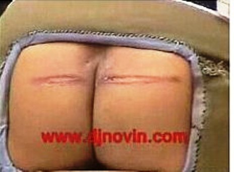 เฆี่ยน... ทัณฑกรรมที่ยังจำเป็นในหลายอารยะประเทศ