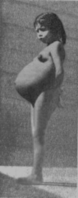 Lina_Medina