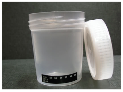 ฟ้องร้องอสุจิ