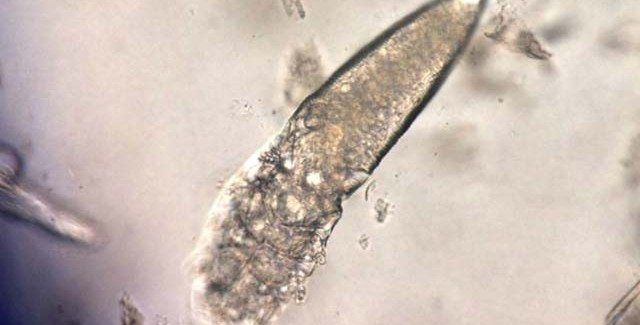 มีไรหรอ&hellip;มีสิ! มีไรอยู่บนหน้าของเราเต็มไปหมดเลย!!