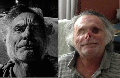 เสพจนมีสภาพเป็นแบบนี้