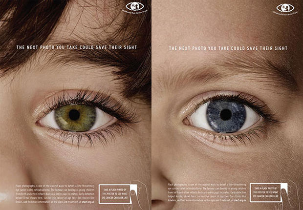 ตรวจหาโรคมะเร็งดวงตาในเด็กโดยการถ่ายภาพเปิดแฟลช.jpg