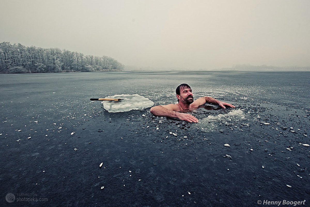 10-มนุษย์ประหลาด-เกิดมาพร้อมความพิเศษสุดเหลือเชื่อ8