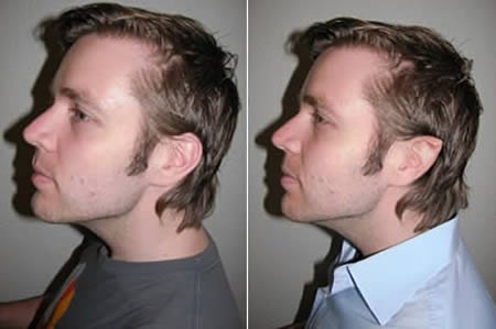 รวมแฟชั่นแปลก หลุดโลก ที่คนทั่วไปไม่กล้าทำตาม รวมแฟชั่นแปลก หลุดโลก ที่คนทั่วไปไม่กล้าทำตาม