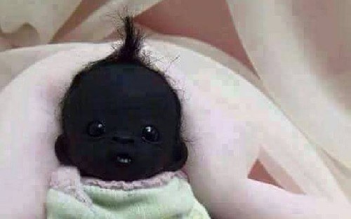 ทารกผิวสีดำสนิท