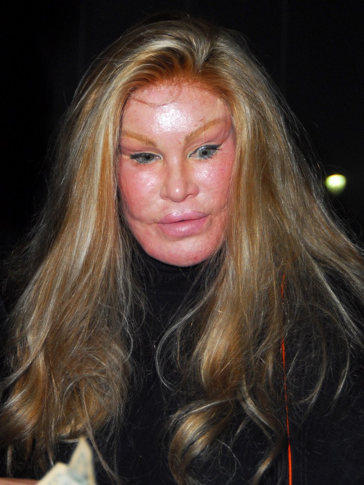 Jocelyn Wildenstein Famous for her extensive plastic surgery leaving Katsuya restaurant in Hollywood after dining with a male companion Los Angeles, California - 18.02.08 Featuring: Jocelyn Wildenstein Where: Los Angeles, California, United States When: 18 Feb 2008 </p><p>Wildensteinยังไงดีไม่เข้าใจ<br />An Interesting Hobby</p><p style=