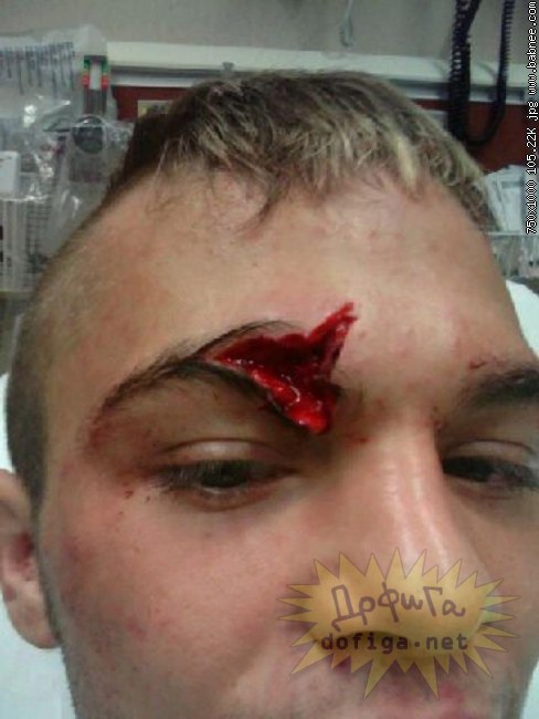 Credit by babnee.com