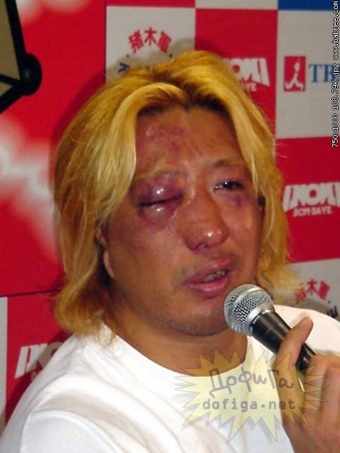 Credit by babnee.com