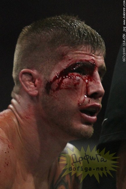 Credit by babnee.com