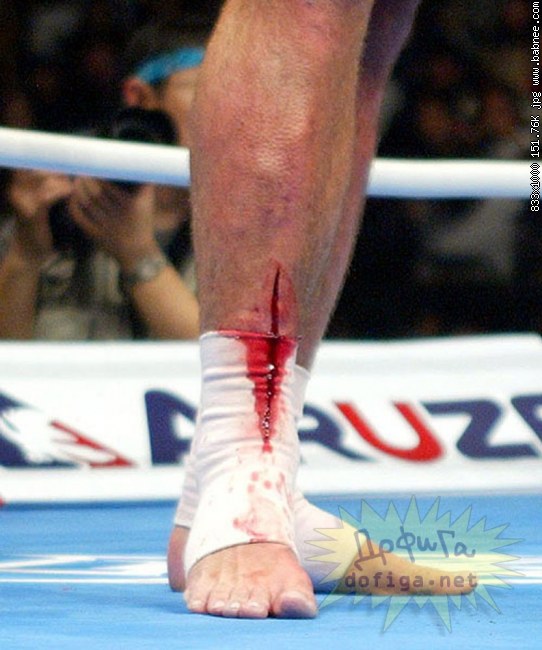 Credit by babnee.com