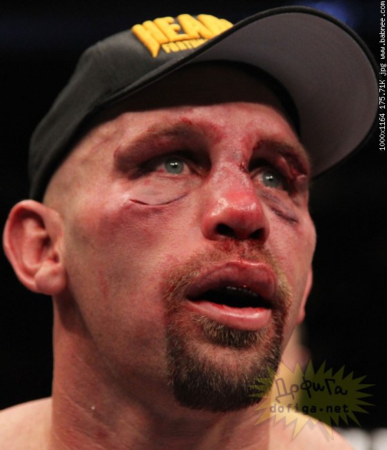 Credit by babnee.com