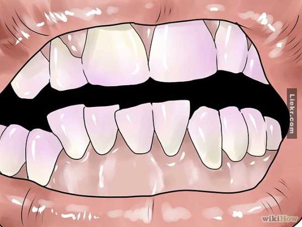 5 วิธีขจัดคราบหินปูนที่จะทำให้ฟันของคุณขาวสะอาด!