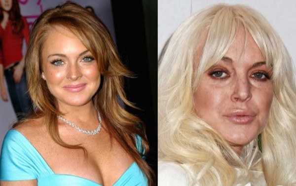 famous-celebrities-look-so-horrible-by-getting-aged-pics-pictures-images-photos (6)
